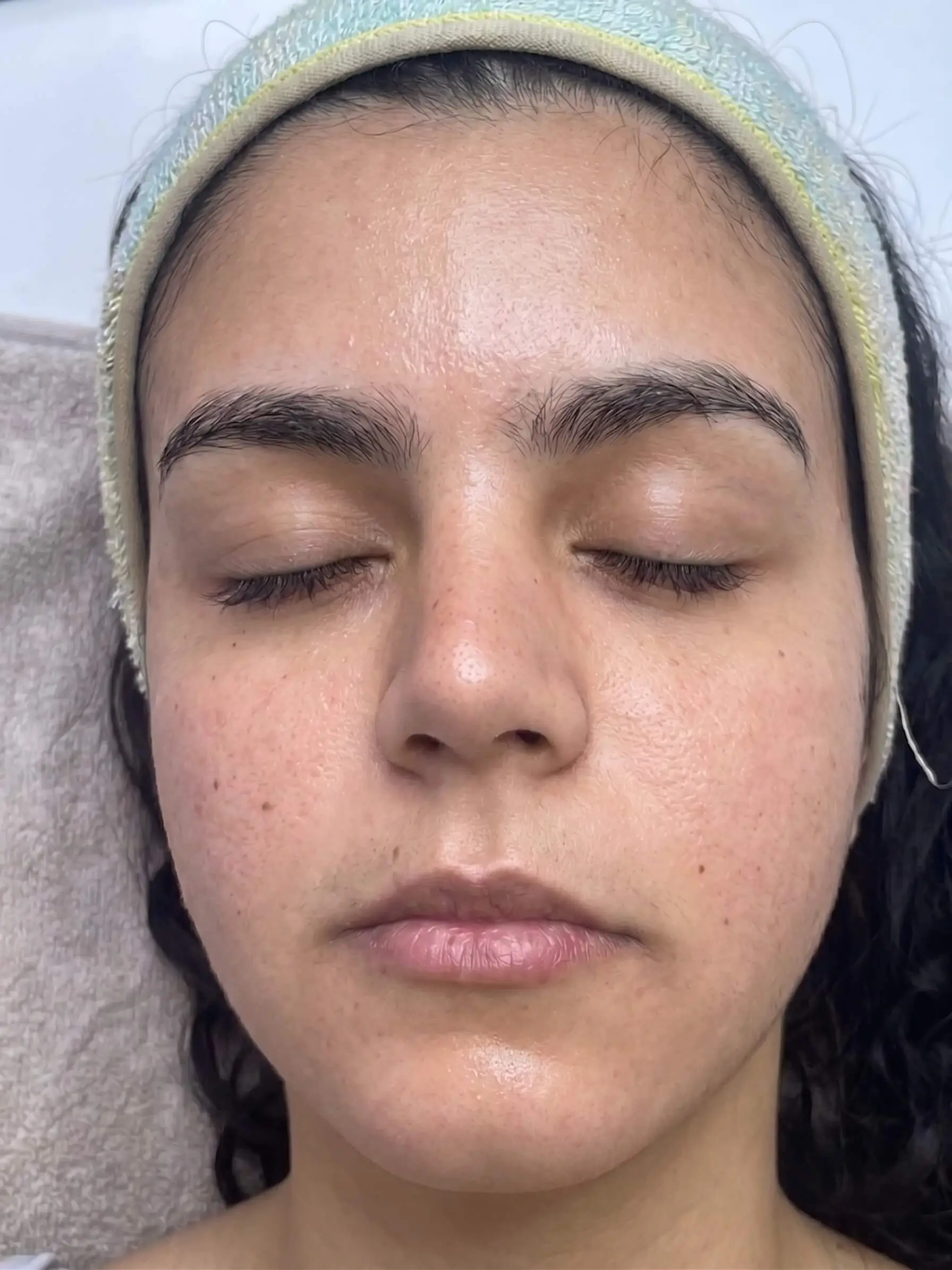 Avant Hydrafacial Spécifique